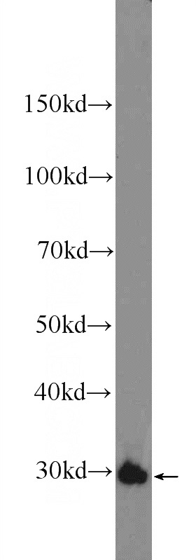 mouse colon tissue were subjected to SDS PAGE followed by western blot with Catalog No:109176(CDX1 Antibody) at dilution of 1:600