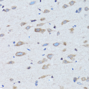 Immunohistochemistry - NDP Polyclonal Antibody 