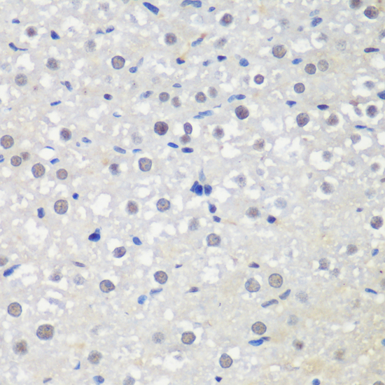 Immunohistochemistry - CTCF Polyclonal Antibody 