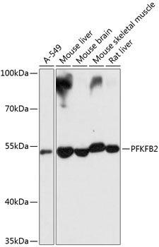 Western blot - PFKFB2 Polyclonal Antibody 