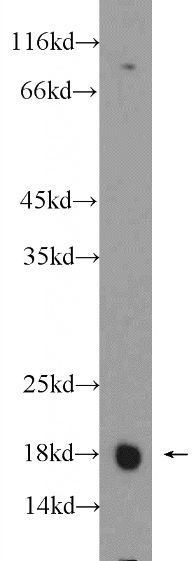 mouse skeletal muscle tissue were subjected to SDS PAGE followed by western blot with Catalog No:108830(CALM2 Antibody) at dilution of 1:300