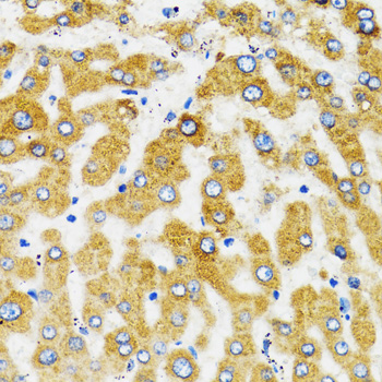 Immunohistochemistry - SLC27A2 Polyclonal Antibody 
