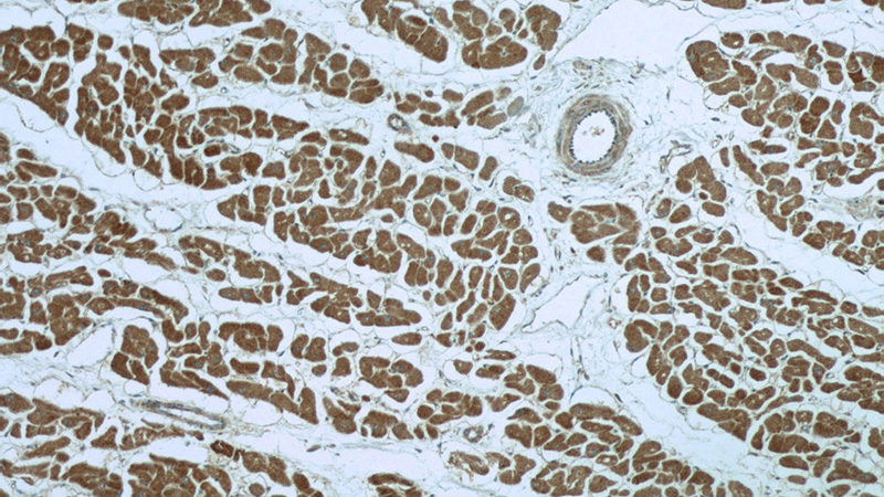 Immunohistochemistry of paraffin-embedded human heart slide using Catalog No:113626(PDK3 Antibody) at dilution of 1:50