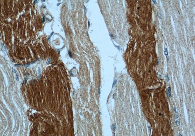 Immunohistochemical of paraffin-embedded human skeletal muscle using Catalog No:107732(ACACA antibody) at dilution of 1:50 (under 40x lens)