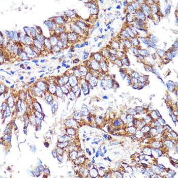 Immunohistochemistry - CNR1 Polyclonal Antibody 