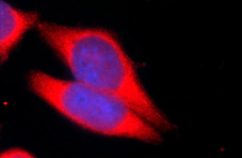 Immunofluorescent analysis of HeLa cells using Catalog No:117202(BMPR1A Antibody) at dilution of 1:25 and Alexa Fluor 594-congugated AffiniPure Goat Anti-Rabbit IgG(H+L)