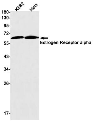 Western blot detection of Estrogen Receptor alpha in K562,Hela cell lysates using Estrogen Receptor alpha Rabbit mAb(1:1000 diluted).Predicted band size:66kDa.Observed band size:66kDa.