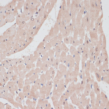 Immunohistochemistry - PRPF31 Polyclonal Antibody 
