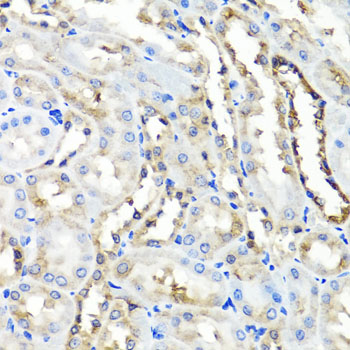 Immunohistochemistry - HYAL1 Polyclonal Antibody 
