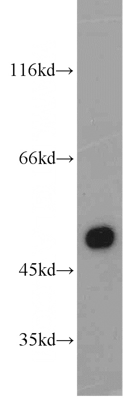 human placenta tissue were subjected to SDS PAGE followed by western blot with Catalog No:109679(CYP11A1 antibody) at dilution of 1:800