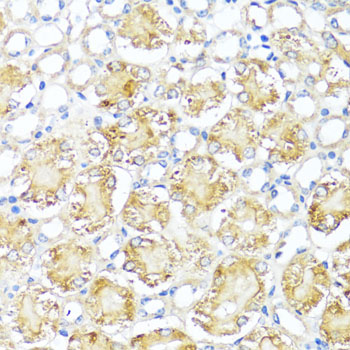 Immunohistochemistry - MAS1 Polyclonal Antibody 