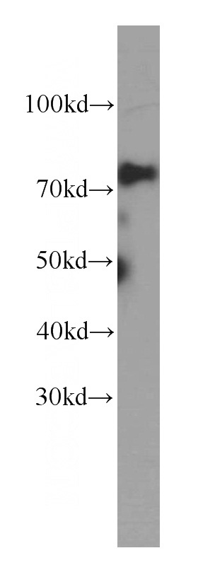 HeLa cells were subjected to SDS PAGE followed by western blot with Catalog No:107432(MTA2 Antibody) at dilution of 1:1000