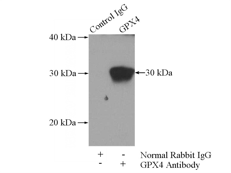 IP Result of anti-GPX4 (IP:Catalog No:111149, 4ug; Detection:Catalog No:111149 1:1000) with mouse kidney tissue lysate 4000ug.