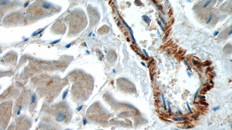 Immunohistochemistry of paraffin-embedded human heart tissue slide using Catalog No:113131(NAV1 Antibody) at dilution of 1:200 (under 40x lens).