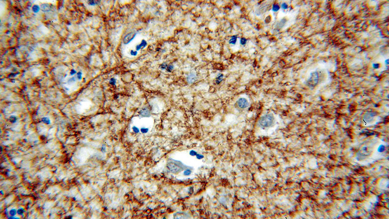 Immunohistochemical of paraffin-embedded human brain using Catalog No:113690(PCDH11X antibody) at dilution of 1:50 (under 40x lens)