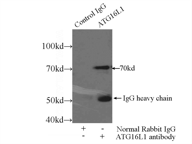 IP Result of anti-ATG16L1 (IP:Catalog No:108291, 4ug; Detection:Catalog No:108291 1:300) with MCF-7 cells lysate 2000ug.