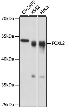 Western blot - FOXL2 Polyclonal Antibody 