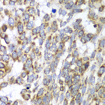 Immunohistochemistry - DLST Polyclonal Antibody 