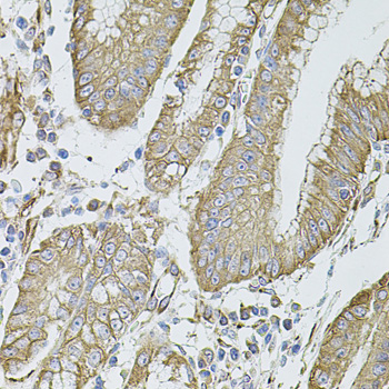 Immunohistochemistry - FLNB Polyclonal Antibody 