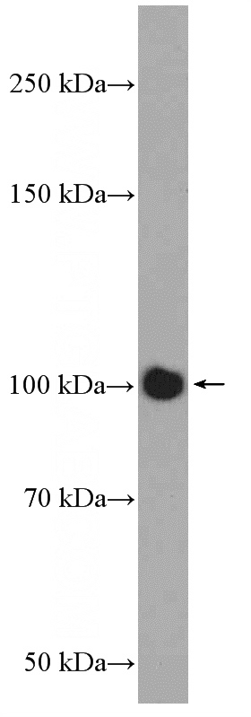 mouse brain tissue were subjected to SDS PAGE followed by western blot with Catalog No:109850(DAAM2 Antibody) at dilution of 1:600