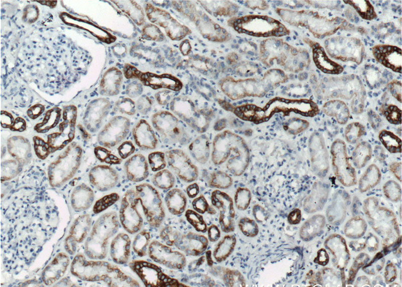 Immunohistochemistry of paraffin-embedded human kidney tissue slide using Catalog No:107231(KRT18 Antibody) at dilution of 1:1200 (under 10x lens). Heat mediated antigen retrieved with Citric acid buffer, pH6.0