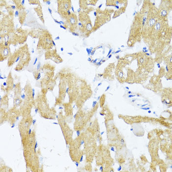 Immunohistochemistry - GLUT4 Polyclonal Antibody 