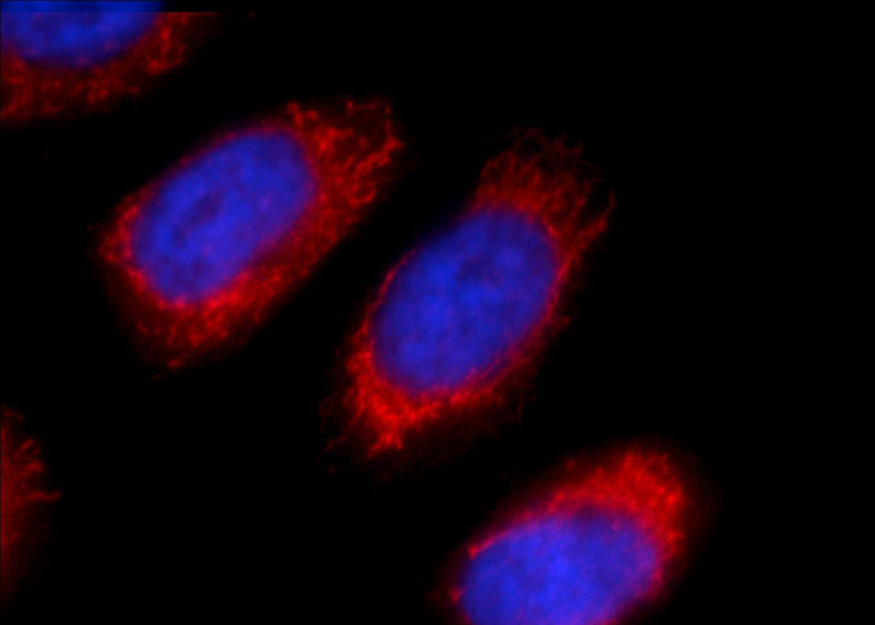 Immunofluorescent analysis of HeLa cells using Catalog No:107823(ACAA1 Antibody) at dilution of 1:25 and Rhodamine-Goat anti-Rabbit IgG