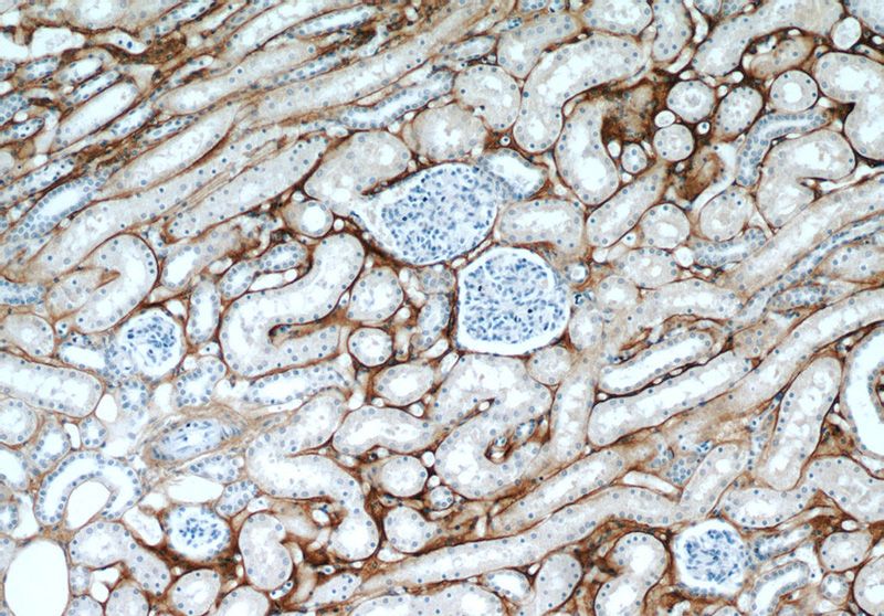 Immunohistochemical of paraffin-embedded human kidney using Catalog No:107621(BIGH3 antibody) at dilution of 1:50 (under 10x lens)