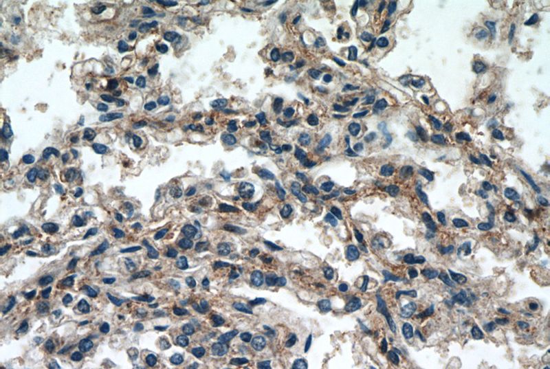 Immunohistochemistry of paraffin-embedded human lung tissue slide using Catalog No:114480(RASIP1 Antibody) at dilution of 1:50 (under 40x lens)