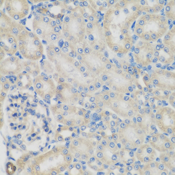 Immunohistochemistry - GPI Polyclonal Antibody 