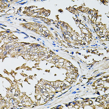 Immunohistochemistry - RASSF5 Polyclonal Antibody 