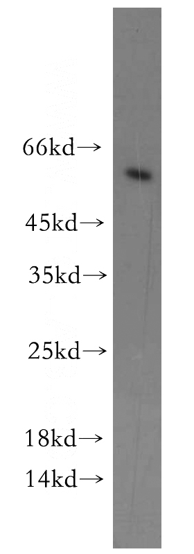 MDA-MB-453s cells were subjected to SDS PAGE followed by western blot with Catalog No:109710(CYP4Z1-Specific antibody) at dilution of 1:300