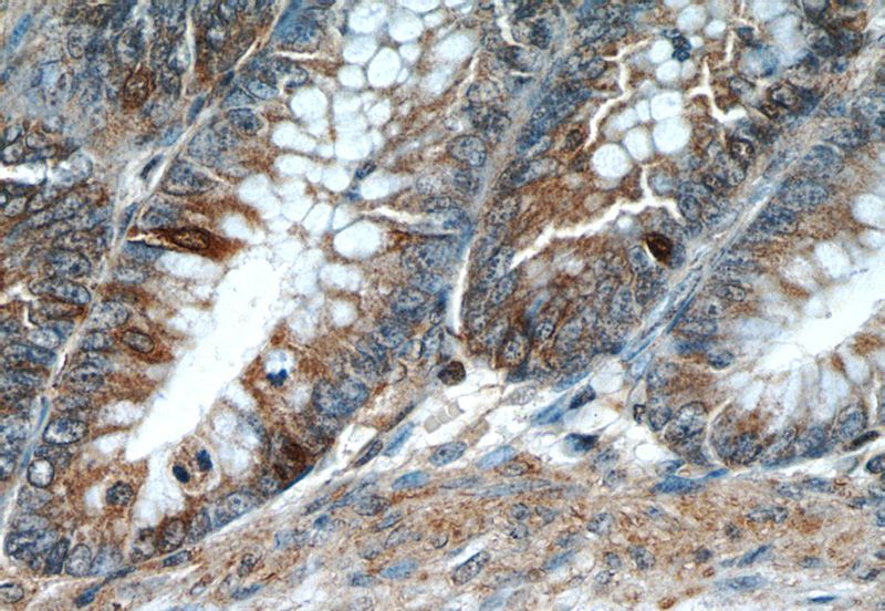 Immunohistochemistry of paraffin-embedded human colon tissue slide using Catalog No:114218(PROK2 Antibody) at dilution of 1:50 (under 40x lens)