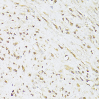 Immunohistochemistry - SNRPA Polyclonal Antibody 