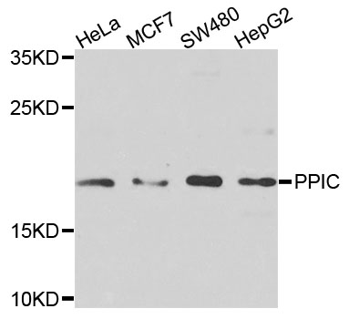 Western blot - PPIC Polyclonal Antibody 