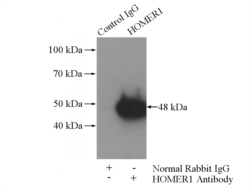 IP Result of anti-HOMER1 (IP:Catalog No:111517, 4ug; Detection:Catalog No:111517 1:800) with mouse brain tissue lysate 4000ug.