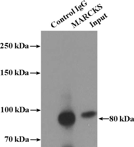 IP Result of anti-MARCKS (IP:Catalog No:112447, 4ug; Detection:Catalog No:112447 1:300) with A431 cells lysate 1200ug.