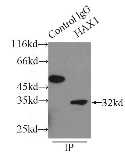 IP Result of anti-HAX1 (IP:Catalog No:111263, 3ug; Detection:Catalog No:111263 1:300) with mouse brain tissue lysate 6000ug.