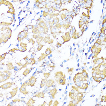 Immunohistochemistry - ALDH6A1 Polyclonal Antibody 