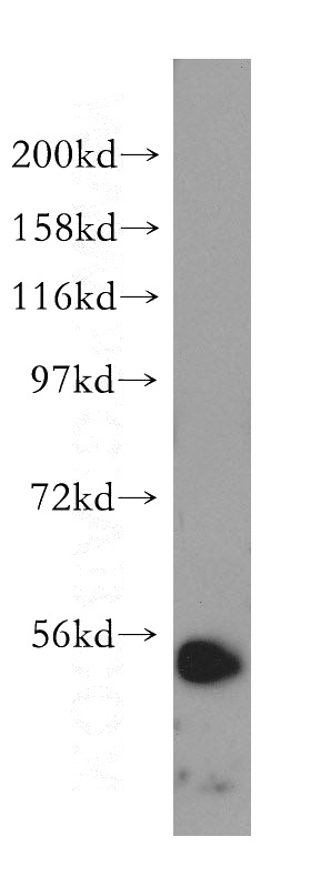 HeLa cells were subjected to SDS PAGE followed by western blot with Catalog No:112301(LPCAT2 antibody) at dilution of 1:400