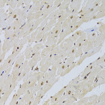 Immunohistochemistry - SNRPA Polyclonal Antibody 