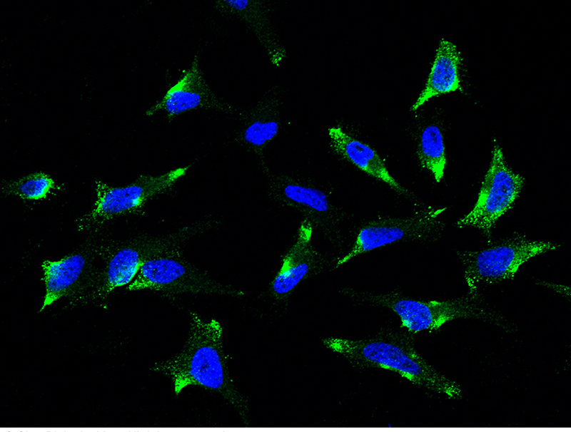 Human SR-BI/SCARB1/CD36L1 Immunofluorescence(IF) 15664