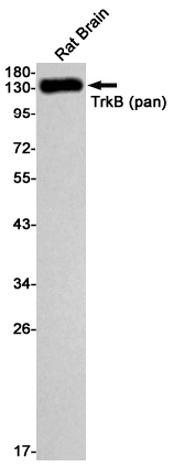 Western blot detection of TrkB (pan) in Rat Brain cell using TrkB (pan) Rabbit mAb(1:1000 diluted).Predicted band size:92kDa.Observed band size:120-140kDa.