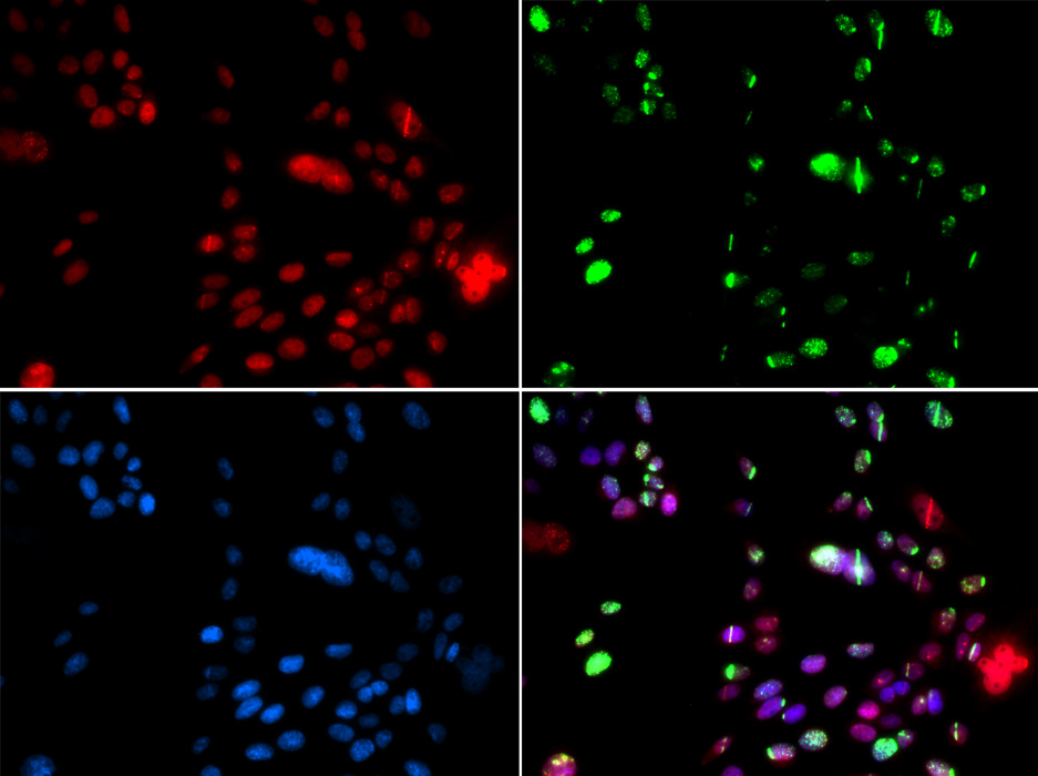 Immunofluorescence - PIAS1 Polyclonal Antibody 