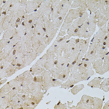 Immunohistochemistry - PPP2R5C Polyclonal Antibody 