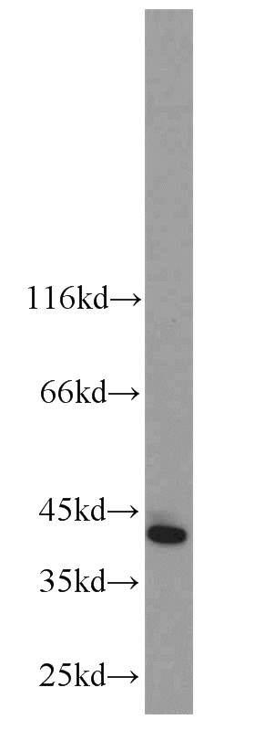 MCF7 cells were subjected to SDS PAGE followed by western blot with Catalog No:109600(CSNK1A1 antibody) at dilution of 1:1000