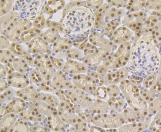 Fig8:; Immunohistochemical analysis of paraffin-embedded mouse kidney tissue using anti-TNPO3 antibody. The section was pre-treated using heat mediated antigen retrieval with sodium citrate buffer (pH 6.0) for 20 minutes. The tissues were blocked in 5% BSA for 30 minutes at room temperature, washed with ddH; 2; O and PBS, and then probed with the primary antibody ( 1/50) for 30 minutes at room temperature. The detection was performed using an HRP conjugated compact polymer system. DAB was used as the chromogen. Tissues were counterstained with hematoxylin and mounted with DPX.