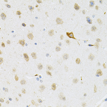 Immunohistochemistry - SYK Polyclonal Antibody 