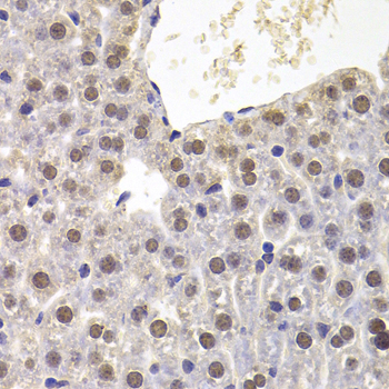 Immunohistochemistry - PRDM5 Polyclonal Antibody 