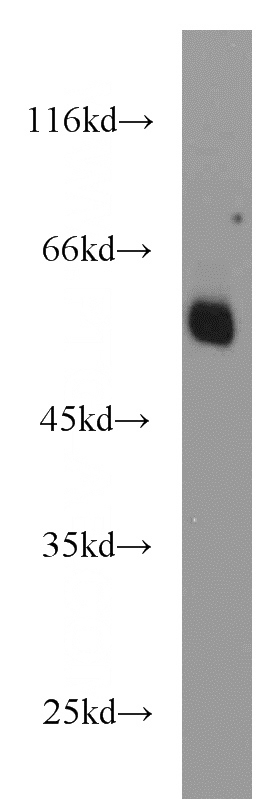 A549 cells were subjected to SDS PAGE followed by western blot with Catalog No:117111(BCS1L antibody) at dilution of 1:1000